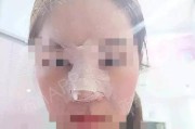 充电器扎伤嘴巴后的紧急处理方法？