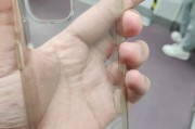 手机壳后背开口处理方法是什么？