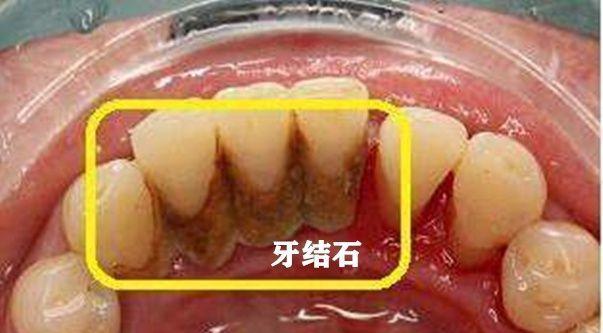 榨汁杯不插电源会坏的原因是什么？
