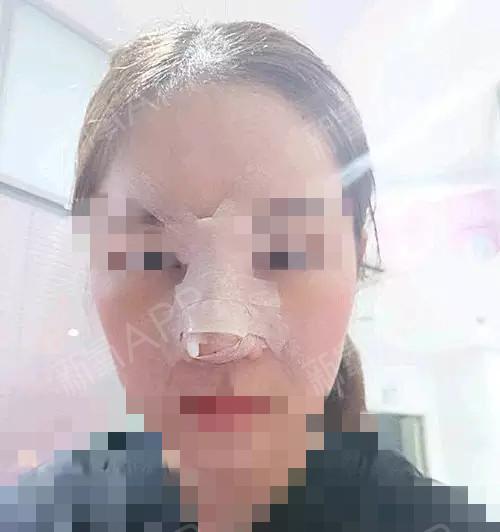 充电器扎伤嘴巴后的紧急处理方法？